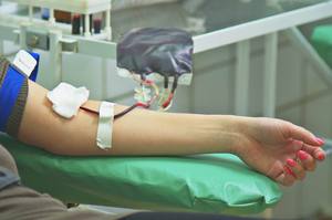 Способ избавления от прыщей с помощью переливания крови