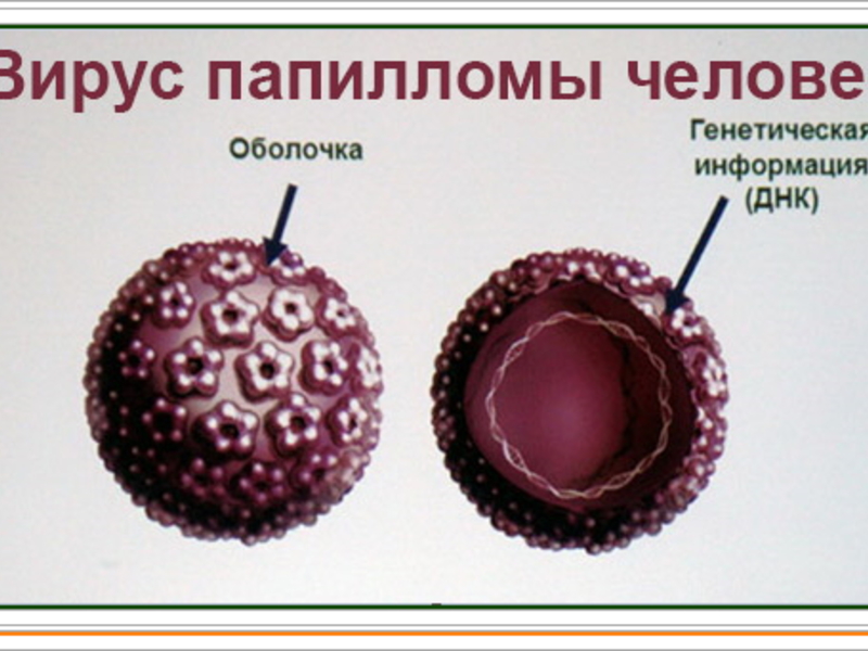 Тип вируса папилломы