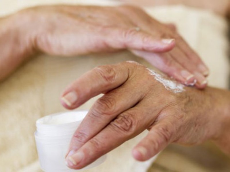 Аллергия на коже рук проявляется дерматитом.