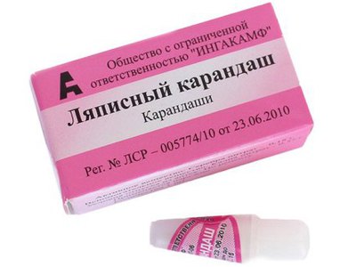 Что означает 3 родинки в ряд на руке