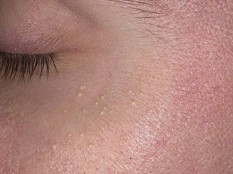 Какие бывают проблемы с кожей лица