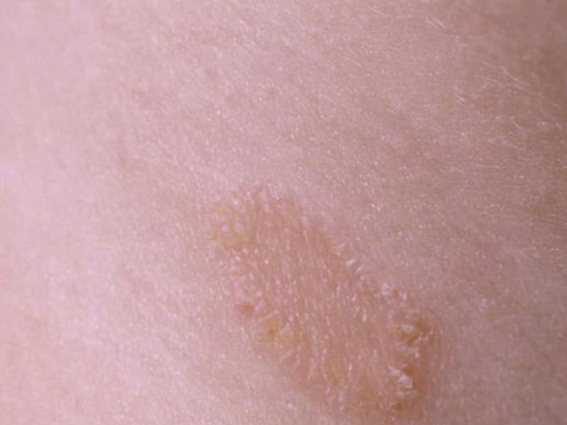 Причины возникновения кожных заболеваний