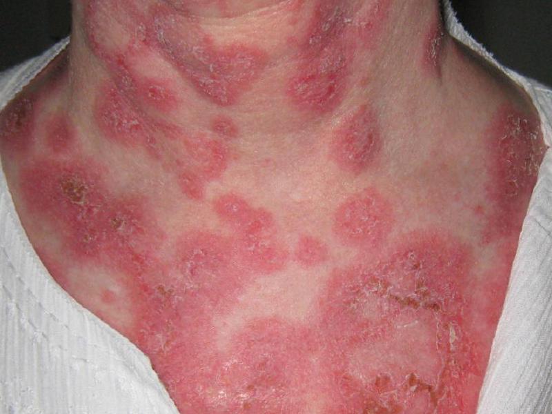 Причины кожных заболеваний